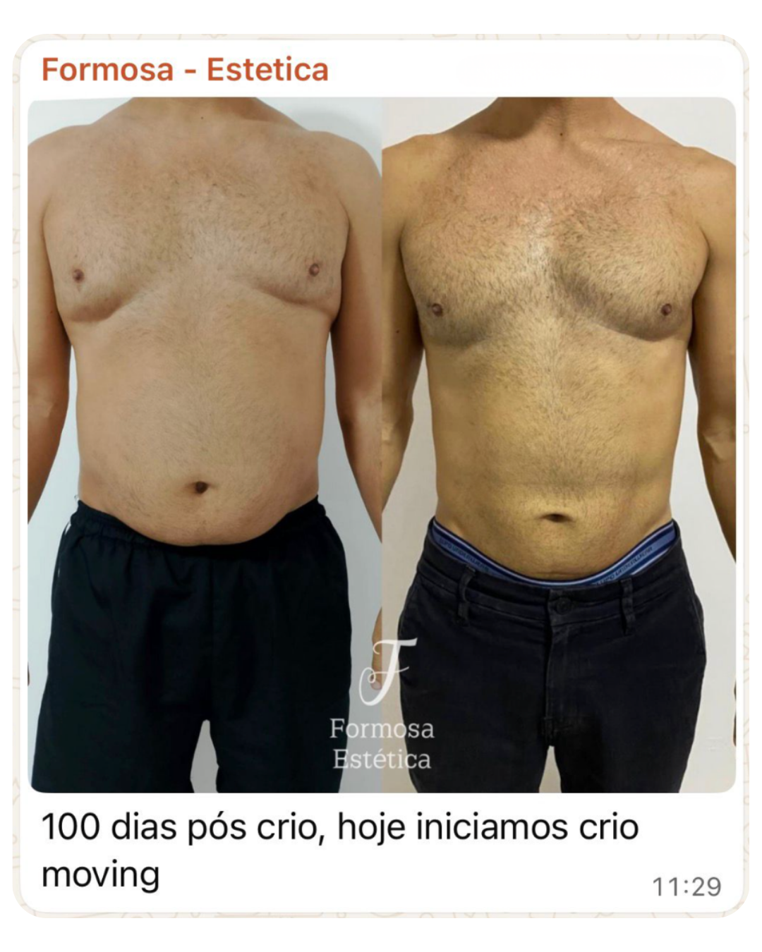 Depoimento aluna 1