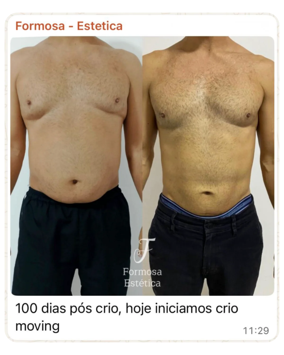Depoimento aluna 1